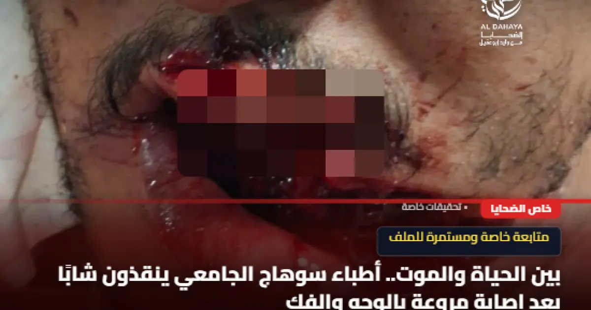بين الحياة والموت.. أطباء سوهاج الجامعي ينقذون شابًا بعد إصابة مروعة بالوجه والفك