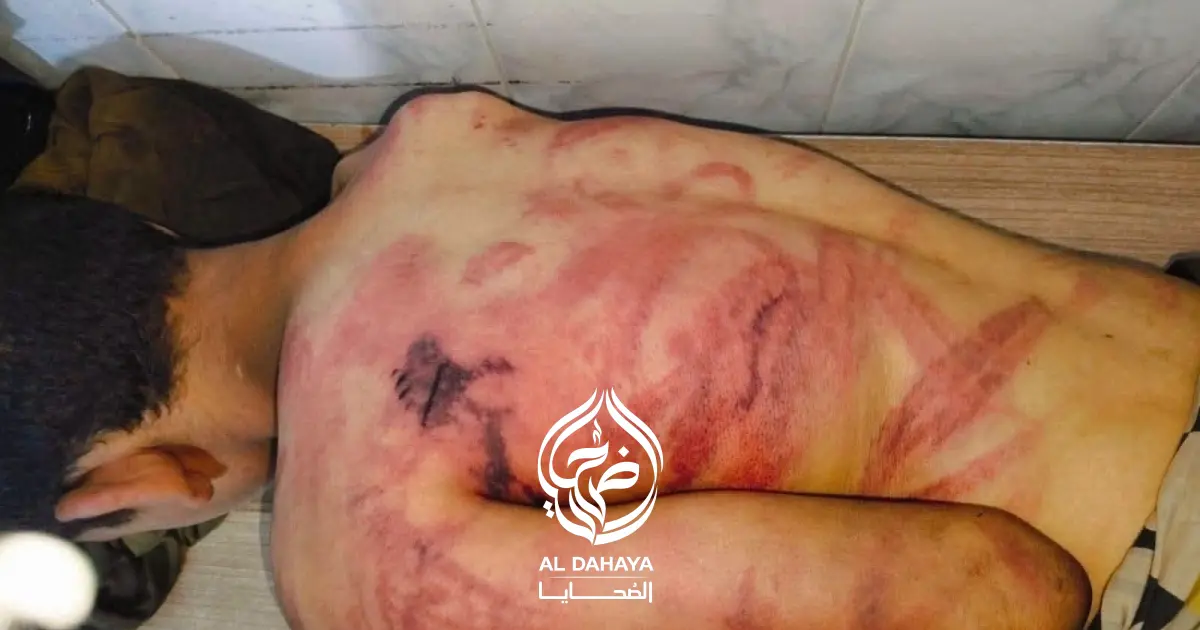بالفيديو :: ضبط شخصين بعد تعذيبهما طفلًا داخل ورشة سيارات بالمنوفية
