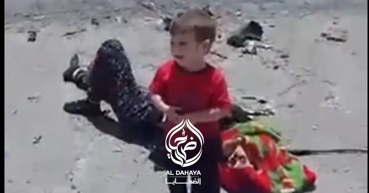 وراء كل حادث قصة ألم.. ضحايا يرحلون وآخرون يعيشون بذاكرة لا تنسى